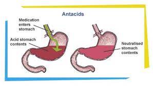 Antacids