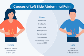 Abdominal Gas Relief